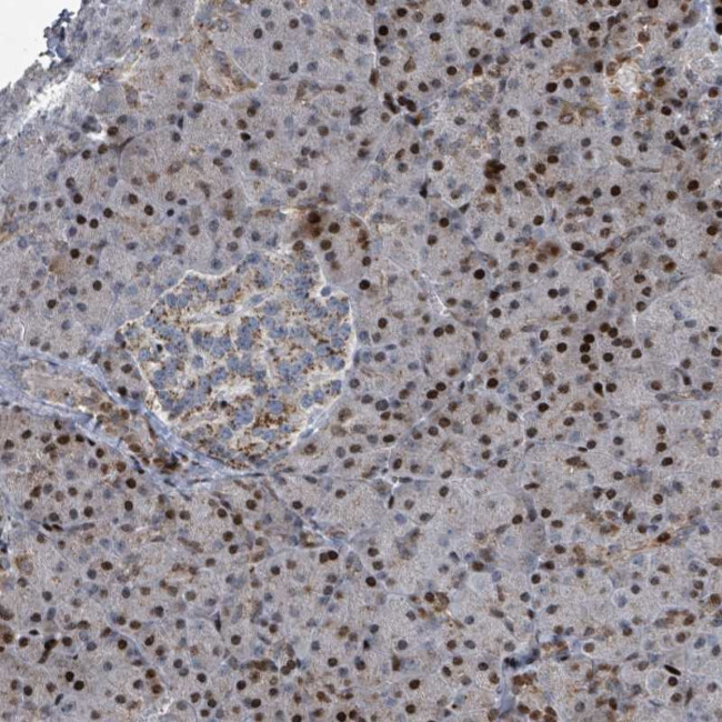 COL20A1 Antibody in Immunohistochemistry (Paraffin) (IHC (P))