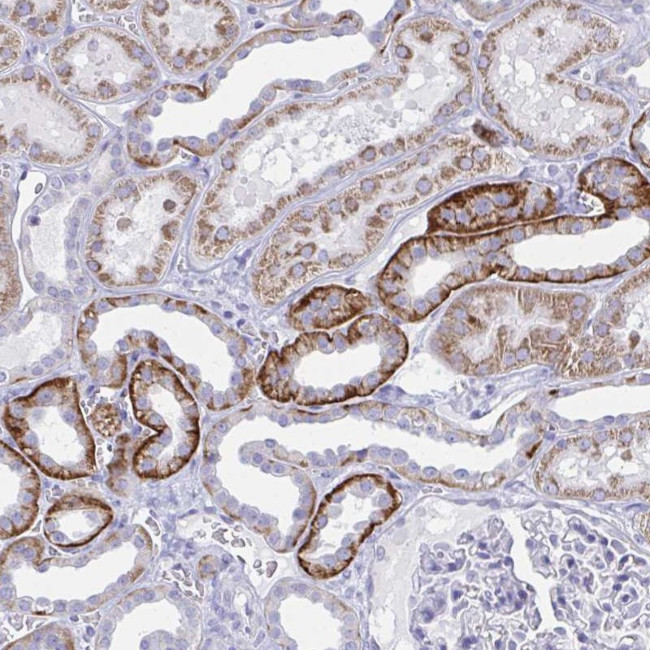 PLEKHH1 Antibody in Immunohistochemistry (Paraffin) (IHC (P))