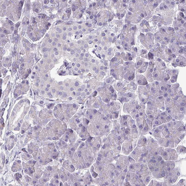 TMEM132A Antibody in Immunohistochemistry (Paraffin) (IHC (P))