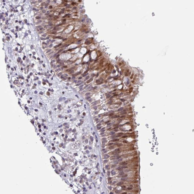 ZCCHC5 Antibody in Immunohistochemistry (Paraffin) (IHC (P))