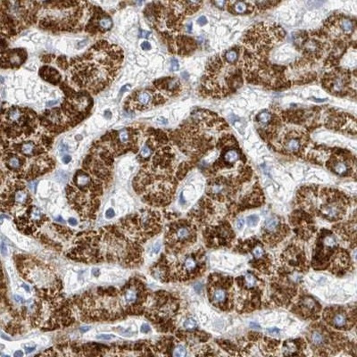 SUCLG2 Antibody in Immunohistochemistry (IHC)