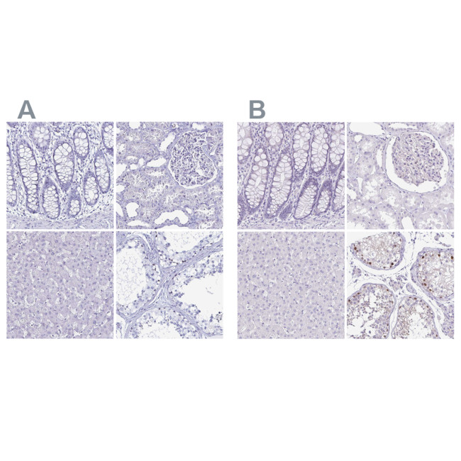 LUZP4 Antibody in Immunohistochemistry (IHC)