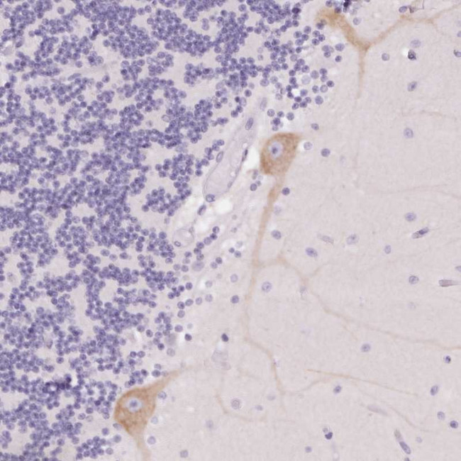 PNLIPRP3 Antibody in Immunohistochemistry (Paraffin) (IHC (P))