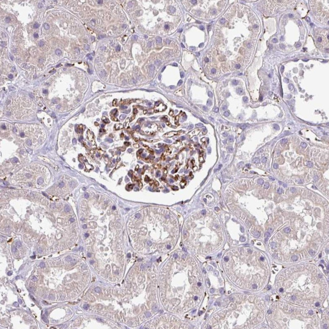 LMO7DN Antibody in Immunohistochemistry (Paraffin) (IHC (P))