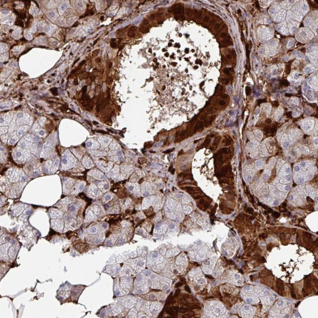 SLC5A10 Antibody in Immunohistochemistry (Paraffin) (IHC (P))