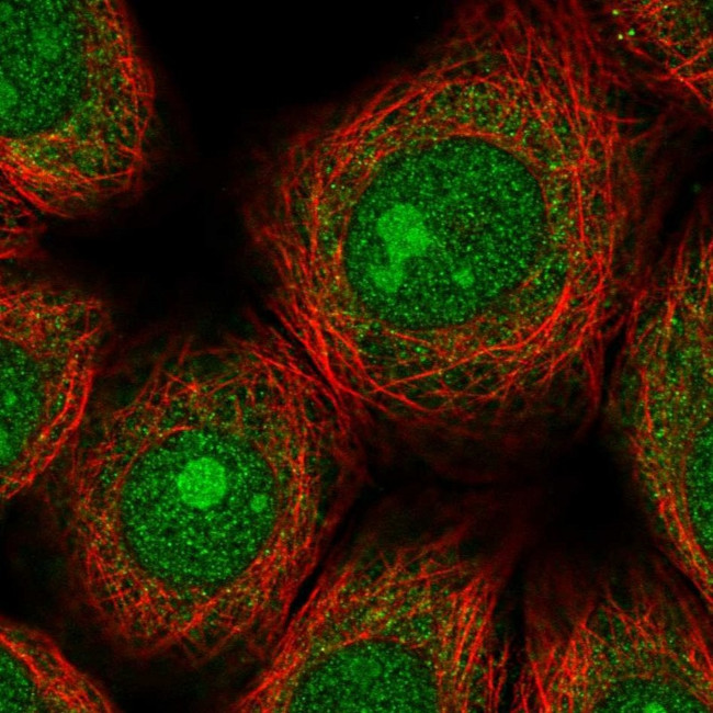 ZNF354A Antibody in Immunocytochemistry (ICC/IF)