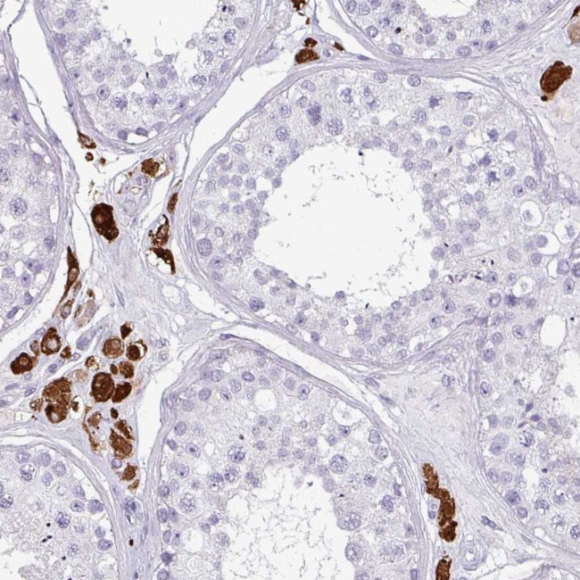 SLC35G2 Antibody in Immunohistochemistry (Paraffin) (IHC (P))