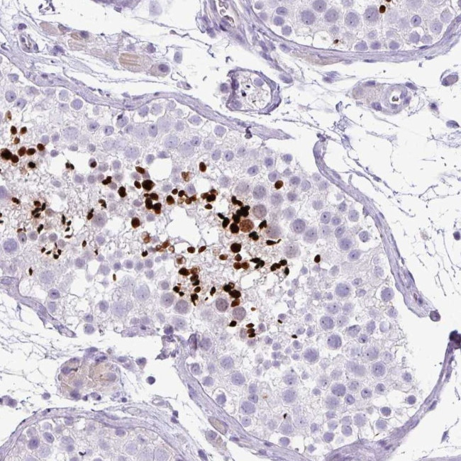 ZNF568 Antibody in Immunohistochemistry (Paraffin) (IHC (P))