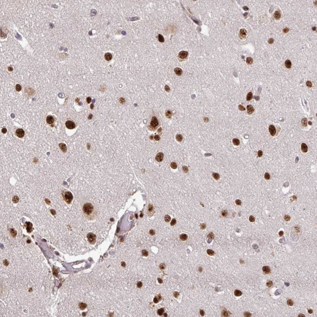 U2AF1 Antibody in Immunohistochemistry (Paraffin) (IHC (P))