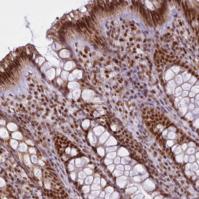 ARL6IP4 Antibody in Immunohistochemistry (Paraffin) (IHC (P))