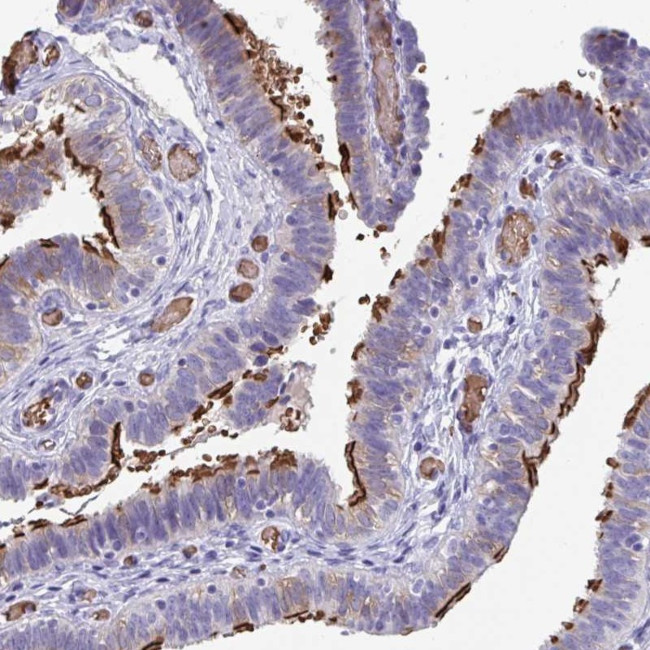 TTC30A Antibody in Immunohistochemistry (Paraffin) (IHC (P))