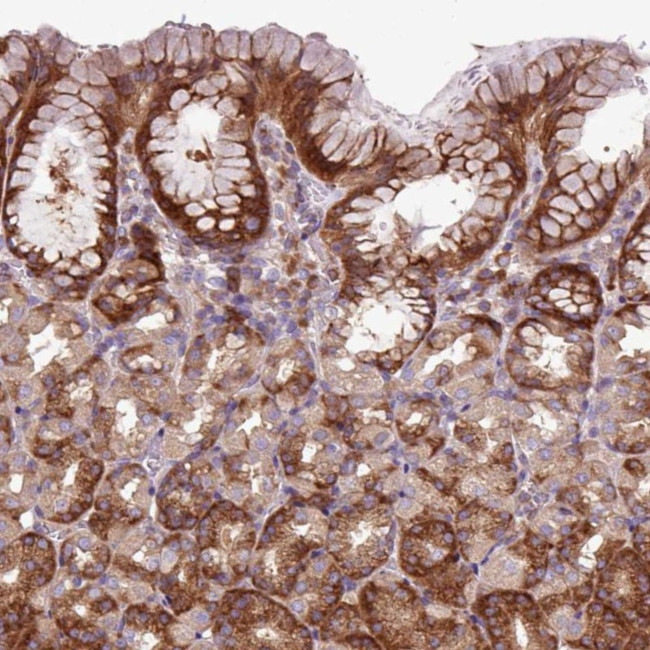 MROH2A Antibody in Immunohistochemistry (Paraffin) (IHC (P))