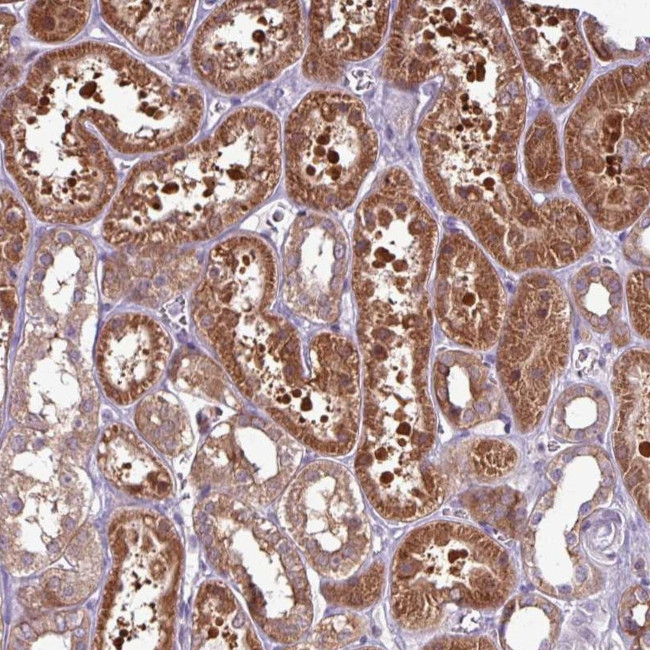 PNMA6A Antibody in Immunohistochemistry (Paraffin) (IHC (P))