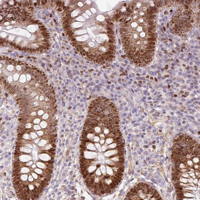 TMEM8B Antibody in Immunohistochemistry (IHC)