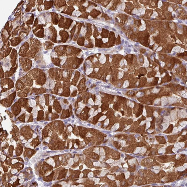 C2orf16 Antibody in Immunohistochemistry (Paraffin) (IHC (P))