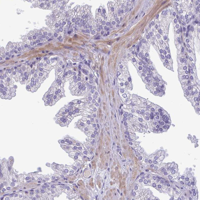 Factor XIII B Antibody in Immunohistochemistry (Paraffin) (IHC (P))