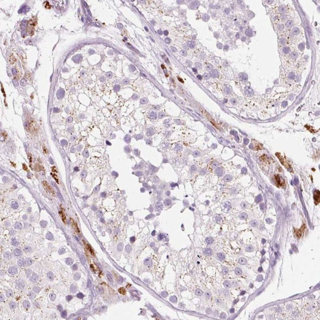 ZNF639 Antibody in Immunohistochemistry (IHC)