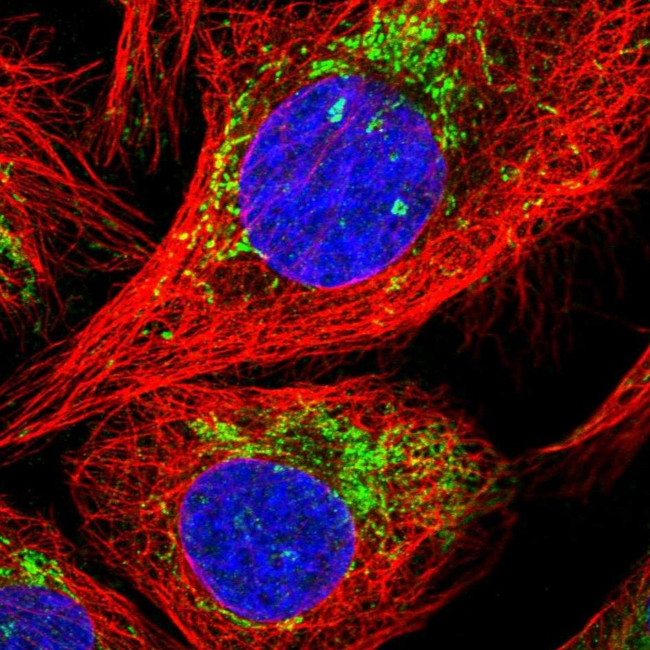 MALSU1 Antibody in Immunocytochemistry (ICC/IF)