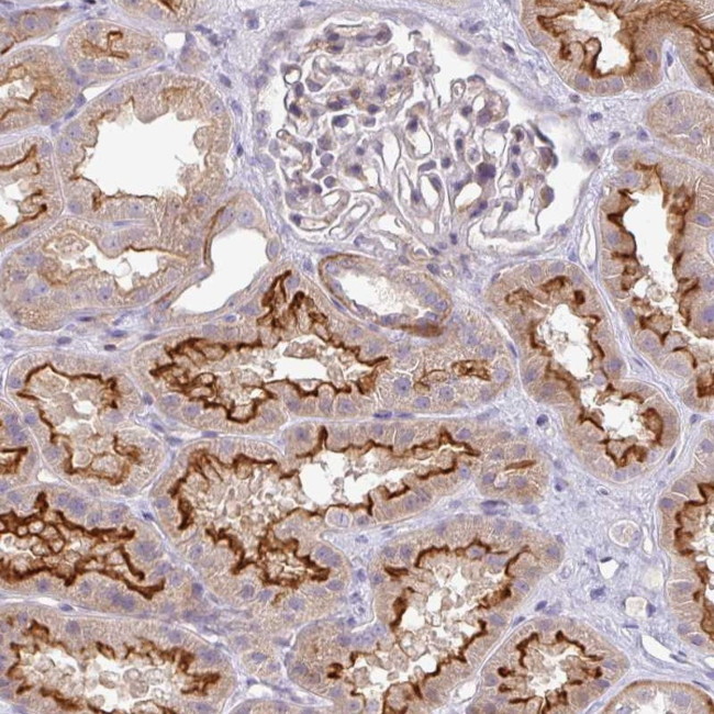 PIK3R5 Antibody in Immunohistochemistry (Paraffin) (IHC (P))