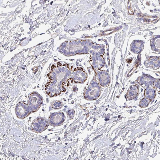 ATP2C2 Antibody in Immunohistochemistry (Paraffin) (IHC (P))