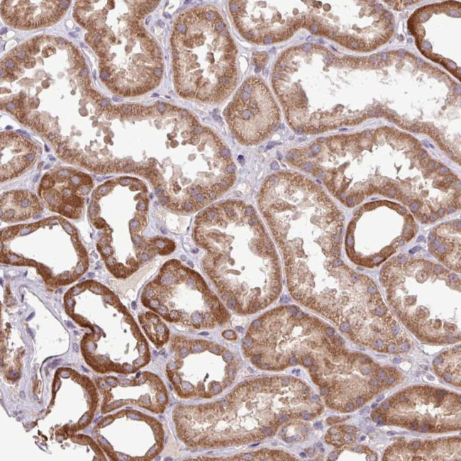 TIMM10B Antibody in Immunohistochemistry (Paraffin) (IHC (P))