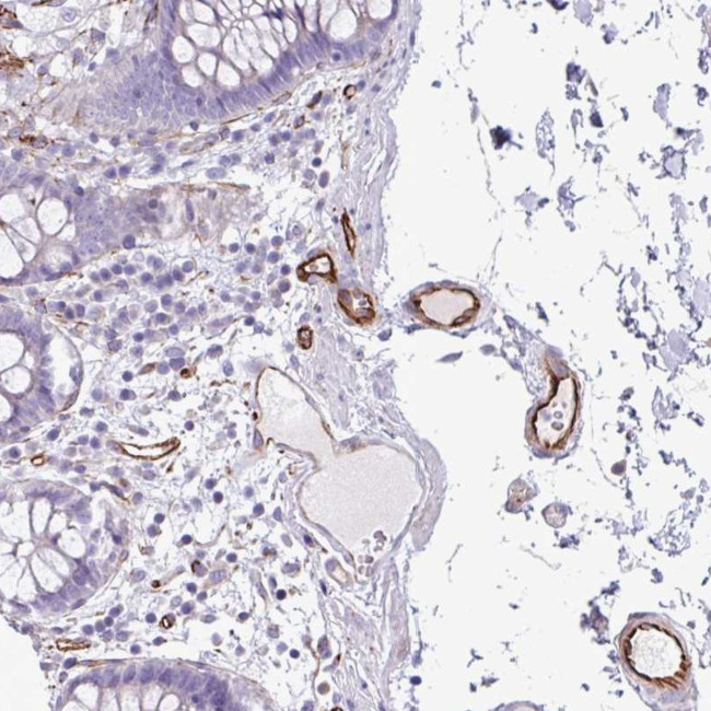 BTD Antibody in Immunohistochemistry (Paraffin) (IHC (P))