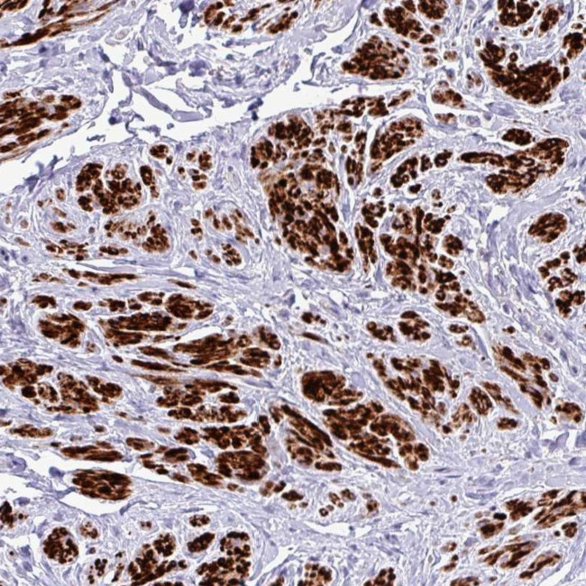 RIPPLY1 Antibody in Immunohistochemistry (Paraffin) (IHC (P))