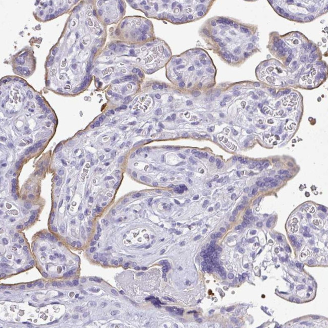 LPPR3 Antibody in Immunohistochemistry (Paraffin) (IHC (P))