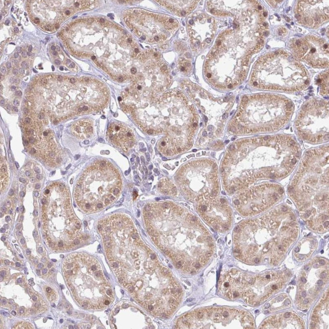 FAM153A Antibody in Immunohistochemistry (Paraffin) (IHC (P))