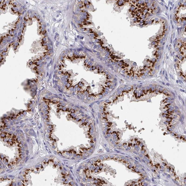 EFTUD1 Antibody in Immunohistochemistry (Paraffin) (IHC (P))