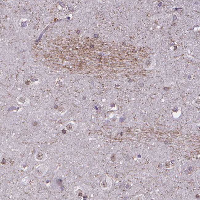 GLRB Antibody in Immunohistochemistry (Paraffin) (IHC (P))