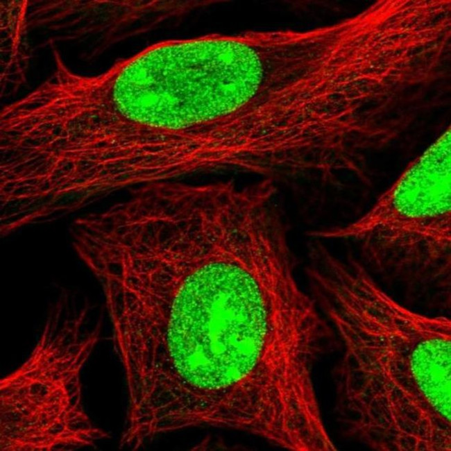 UTP18 Antibody in Immunocytochemistry (ICC/IF)
