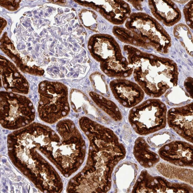 TRAPPC1 Antibody in Immunohistochemistry (Paraffin) (IHC (P))