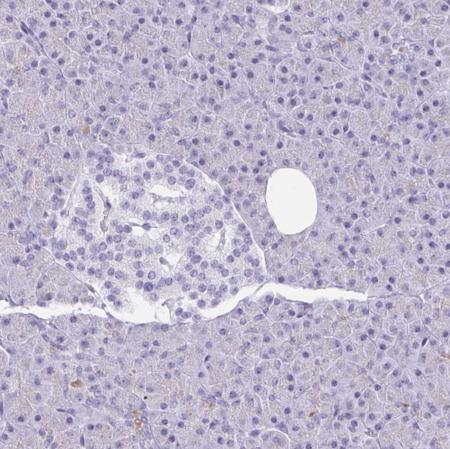 GSDMB Antibody in Immunohistochemistry (Paraffin) (IHC (P))