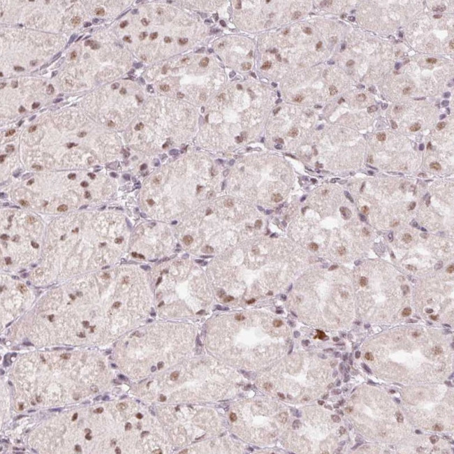 BCAS3 Antibody in Immunohistochemistry (Paraffin) (IHC (P))
