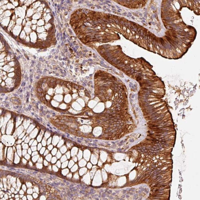 CEP95 Antibody in Immunohistochemistry (Paraffin) (IHC (P))