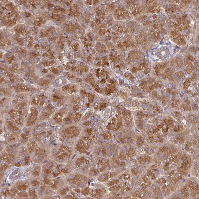 CEP95 Antibody in Immunohistochemistry (Paraffin) (IHC (P))