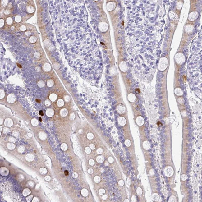 PRAP1 Antibody in Immunohistochemistry (Paraffin) (IHC (P))
