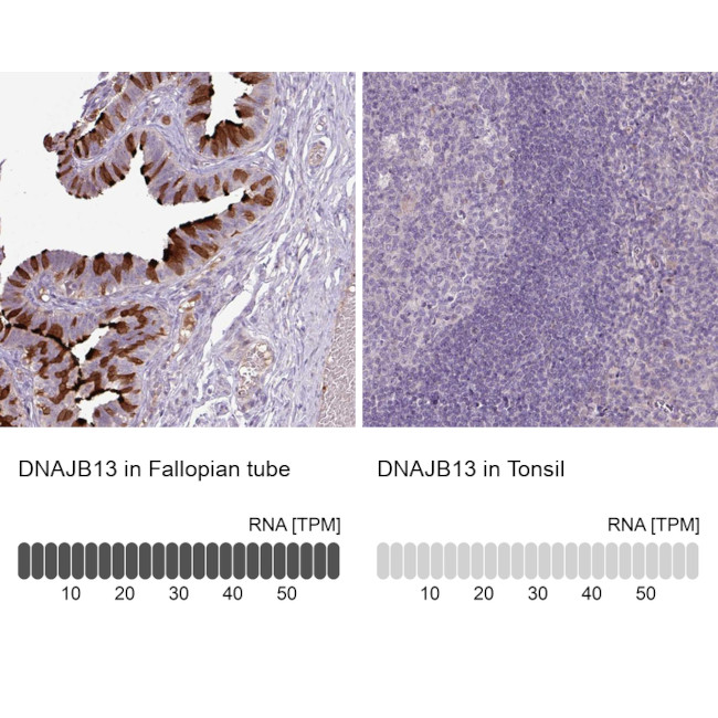 DNAJB13 Antibody in Immunohistochemistry (IHC)