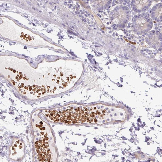 USHBP1 Antibody in Immunohistochemistry (Paraffin) (IHC (P))