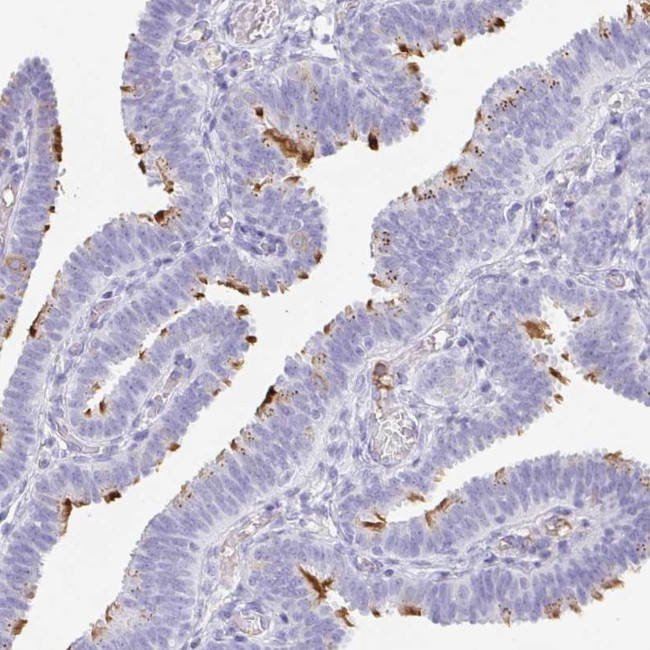 LDLRAD1 Antibody in Immunohistochemistry (Paraffin) (IHC (P))