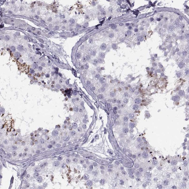 FAM24B Antibody in Immunohistochemistry (IHC)