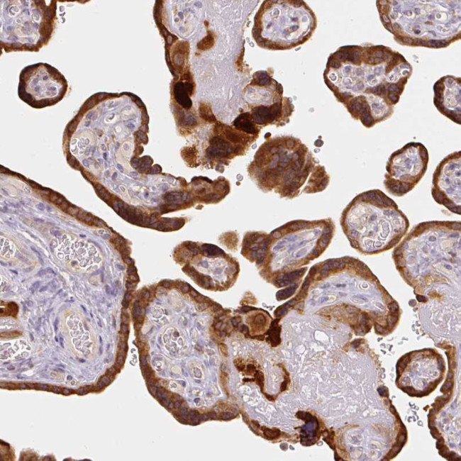 XAGE2 Antibody in Immunohistochemistry (Paraffin) (IHC (P))
