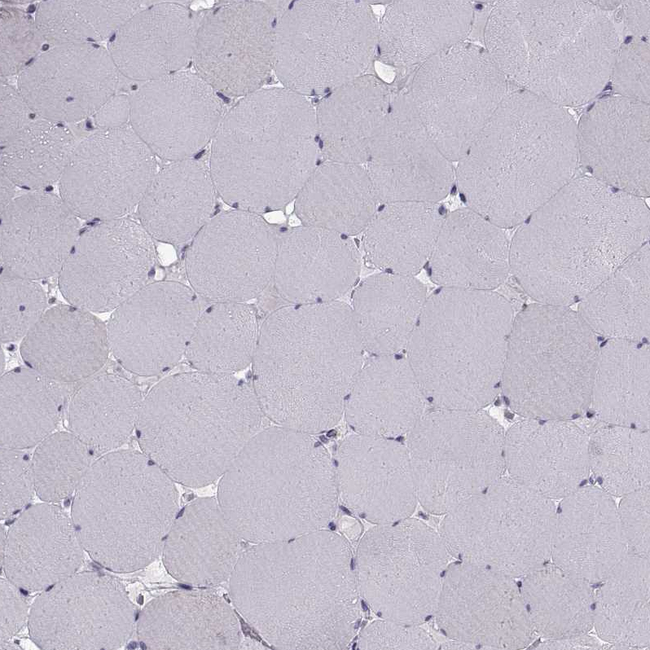 ROPN1B Antibody in Immunohistochemistry (Paraffin) (IHC (P))