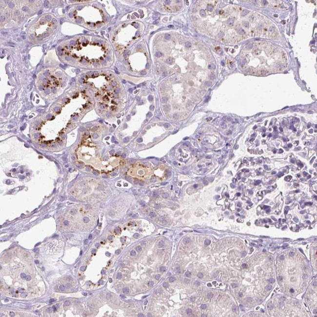 OR2AK2 Antibody in Immunohistochemistry (Paraffin) (IHC (P))