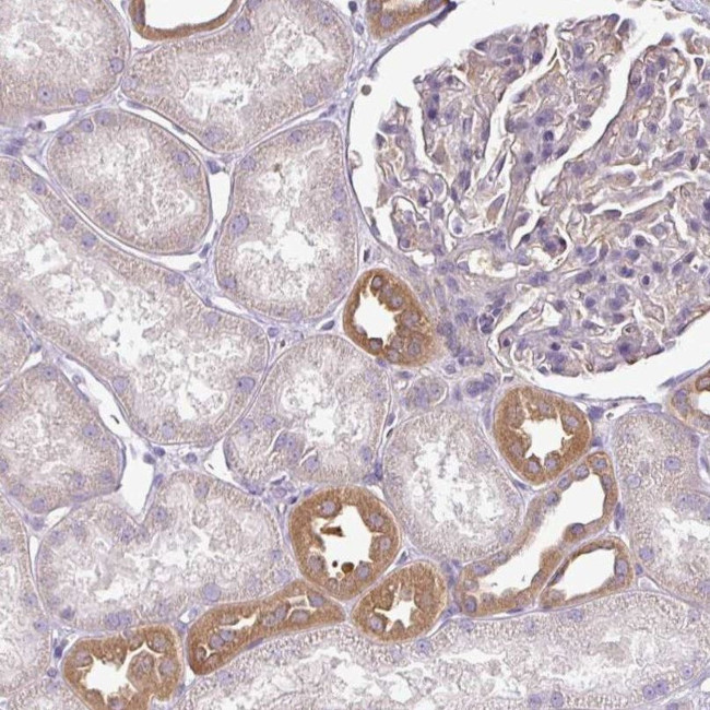 TMEM107 Antibody in Immunohistochemistry (IHC)