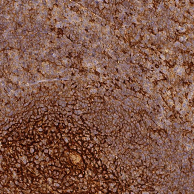 TMEM42 Antibody in Immunohistochemistry (Paraffin) (IHC (P))