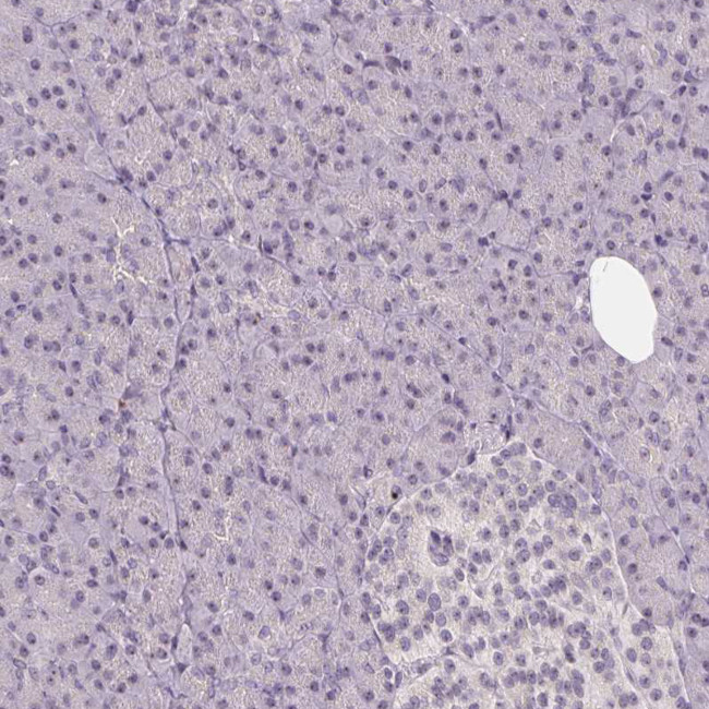 SGF29 Antibody in Immunohistochemistry (Paraffin) (IHC (P))