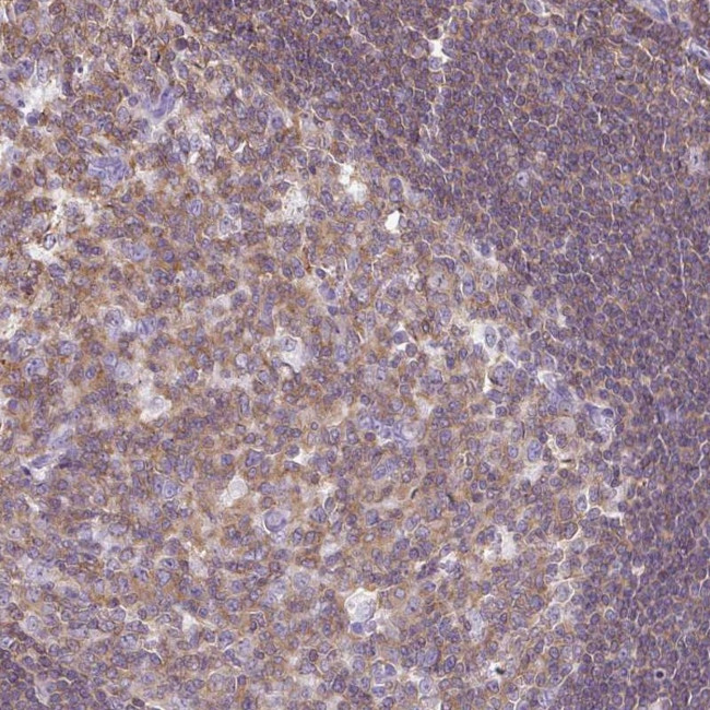 FAM228B Antibody in Immunohistochemistry (Paraffin) (IHC (P))