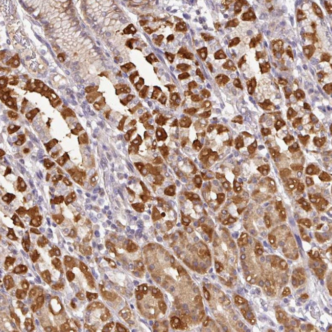 GCNT7 Antibody in Immunohistochemistry (Paraffin) (IHC (P))